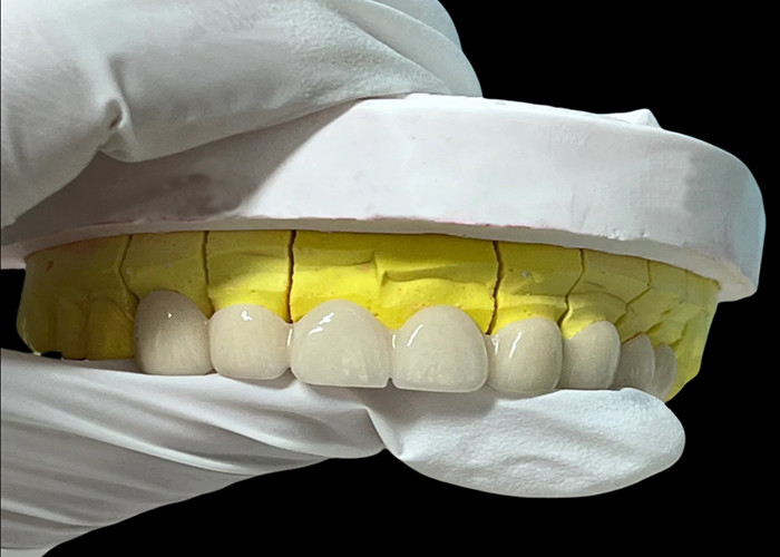 Zirconia porcelana Korona zębowa z estetycznym i naturalnie wyglądającym wykończeniem z chińskiego laboratorium stomatologicznego