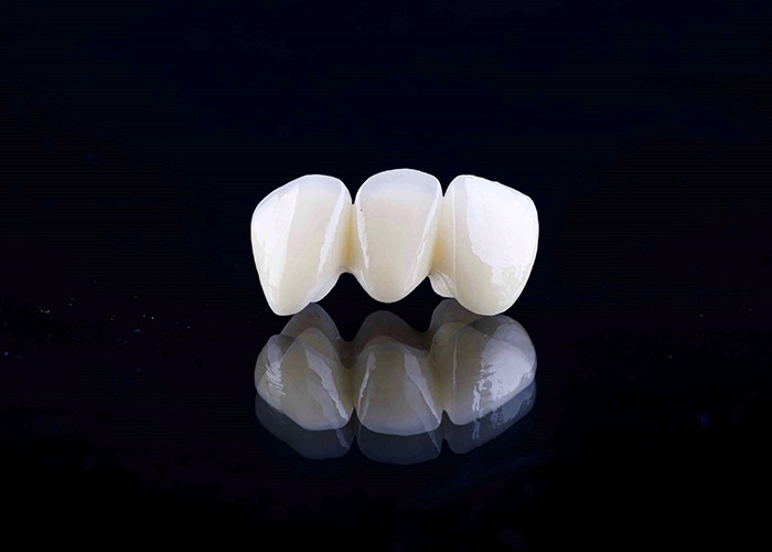 Zirconia porcelana Korona zębowa z estetycznym i naturalnie wyglądającym wykończeniem z chińskiego laboratorium stomatologicznego