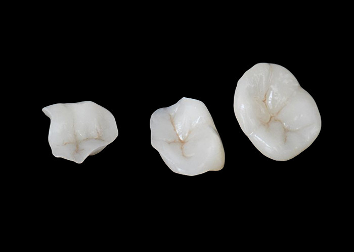 Biokompatybilne ceramiczne wkładki i wkładki zaprojektowane z myślą o wygodnej wytrzymałości i płynnej integracji z naturalnymi zębami