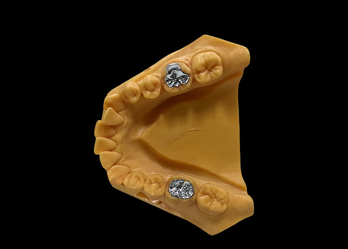 Porcelana stopiona w metalu PFM Korona odporna na zużycie stomatologiczne do odbudowy stomatologii