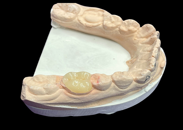 Niestandardowe gładkie ceramiczne wkładki dentystyczne do barwienia odporne na barwienie Bezszwowe naprawy zębów i naturalnej estetyki