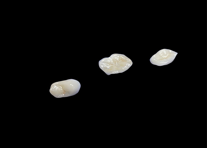 Biokompatybilne ceramiczne wkładki i wkładki zaprojektowane z myślą o wygodnej wytrzymałości i płynnej integracji z naturalnymi zębami