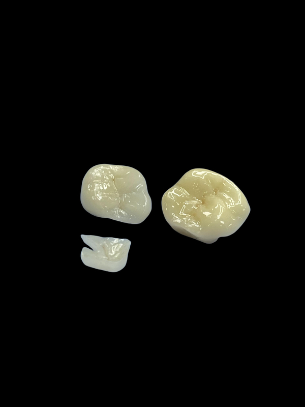 Niedoalergiczne wkładki z porcelany Wkładki do zębów Napraw naturalny kolor i łatwa konserwacja