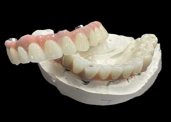 Tytanowa podstawa stały implant wspierane protezy z ceramiczne mostek korony Do zastąpienia brakujących zębów