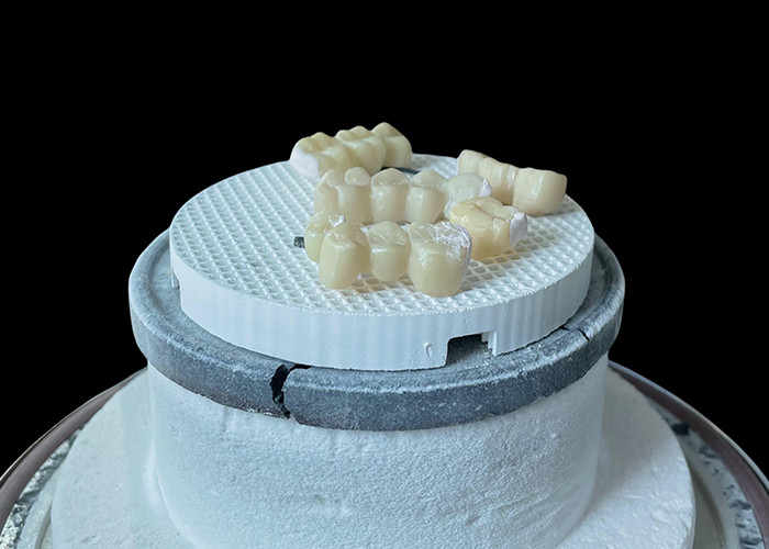 Komfortowy porcelanowy most dentystyczny z konstrukcją całkowicie ceramiczną dla wyjątkowej odporności na zużycie