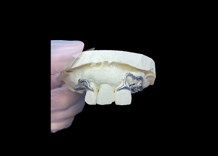 Łatwe dopasowanie Custom Cast Parcial Denture Stabilna i naturalnie wyglądająca ramka dla szybkich wyników