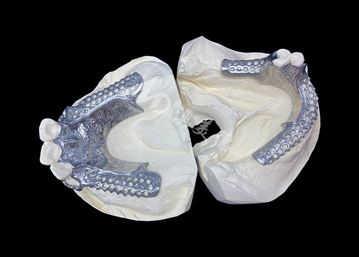 Łatwe dopasowanie Custom Cast Parcial Denture Stabilna i naturalnie wyglądająca ramka dla szybkich wyników
