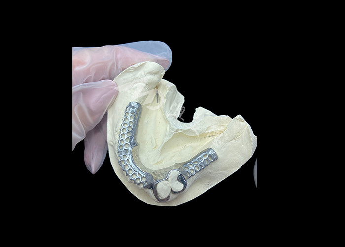 Łatwe dopasowanie Custom Cast Parcial Denture Stabilna i naturalnie wyglądająca ramka dla szybkich wyników