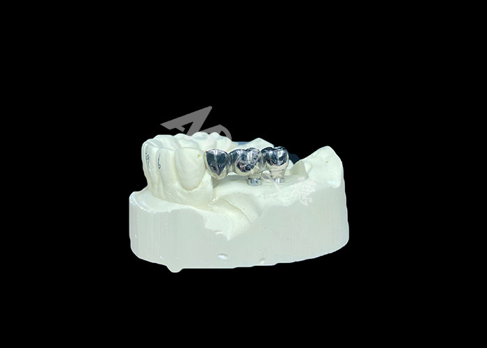 Długotrwały implant zębowy z pełnym odlewem tytanowej korony molarny do wymiany brakujących zębów