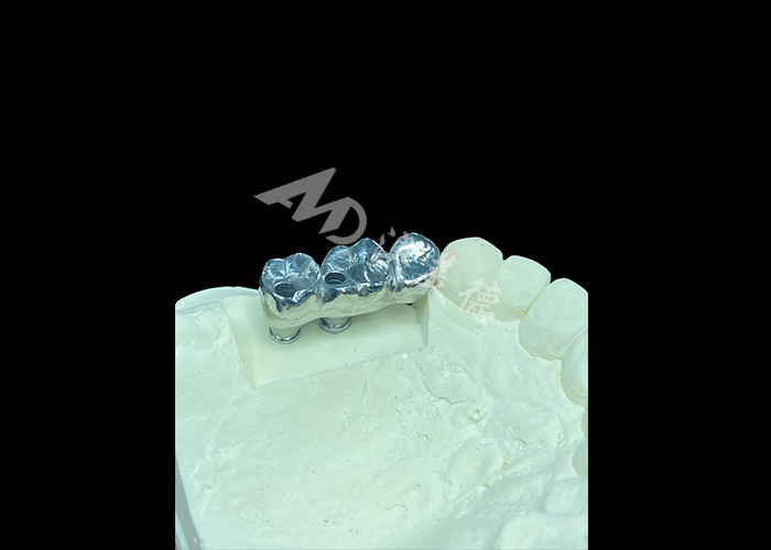 Długotrwały implant zębowy z pełnym odlewem tytanowej korony molarny do wymiany brakujących zębów