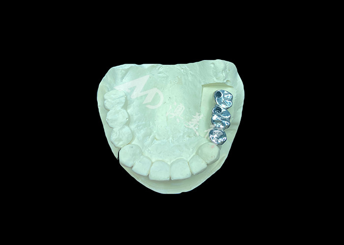 Długotrwały implant zębowy z pełnym odlewem tytanowej korony molarny do wymiany brakujących zębów