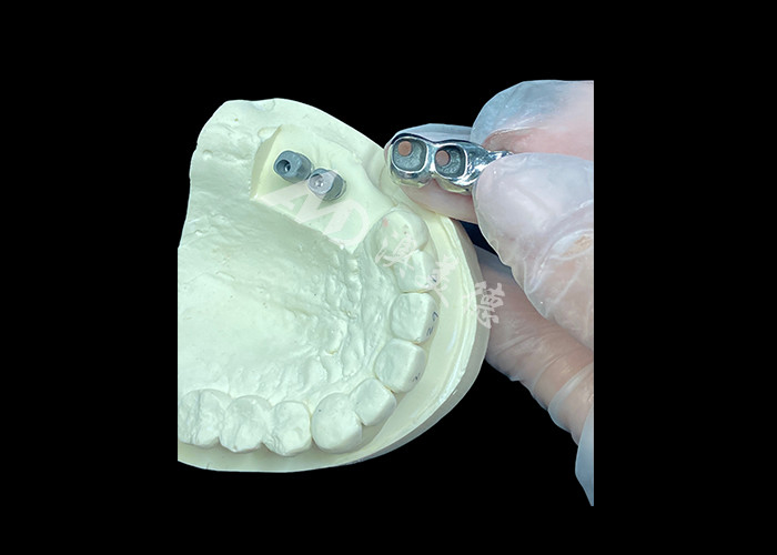 Długotrwały implant zębowy z pełnym odlewem tytanowej korony molarny do wymiany brakujących zębów