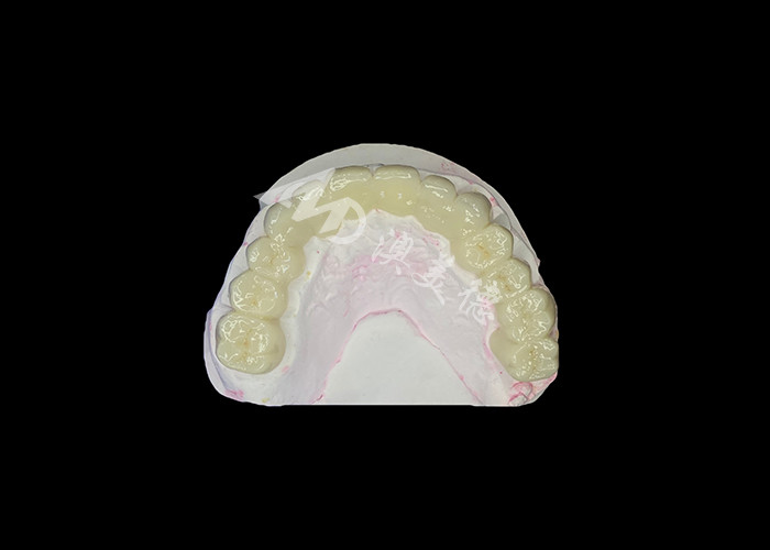Wysokiej przejrzystości Zirconia Dental Bridge Silny i naturalny wygląd dla bezproblemowego odbudowy uśmiechu