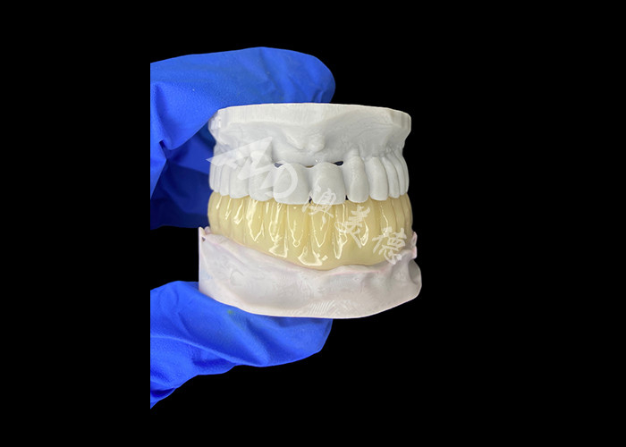 Lekkie Biokompatybilne Drukowane 3D Pustkowy Tymczasowy Mostek do Restauracji Przed Implantami
