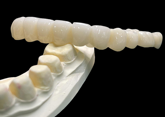 Dobra cena. Vita Classical Shade All Ceramic Crown Bridge Naturalny w poszukiwaniu odbudowy zębów w Internecie