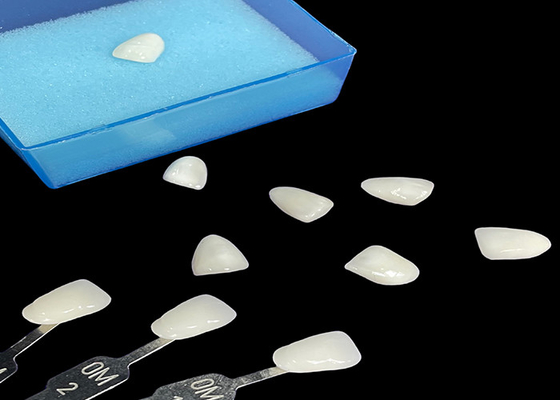 Dobra cena. Porcelan Emax Veneer Translucency Bonding dla precyzyjnych restauracji estetycznych w Internecie