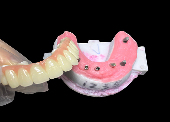 Dobra cena. Implant podtrzymany Całkowity łuk Zęba stałe Implant zębowy Ceramic Crown Bridge w Internecie