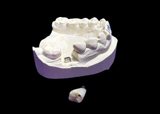 Dobra cena. Implant z ceramiczną koroną i titanium w Internecie