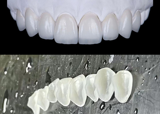 Dobra cena. IPS emax Prasowe foliery porcelanowe uzyskują naturalny i promienny uśmiech w Internecie