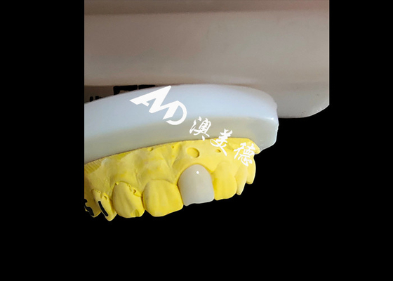 Dobra cena. Naturalny wygląd estetyczny Zirkonia Korona dentystyczna Bezbłędne zęby w Internecie