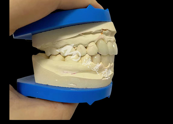Dobra cena. Niezrównana siła Zirkonia Dentalna Korona Dentalna dla naturalnego uśmiechu w Internecie