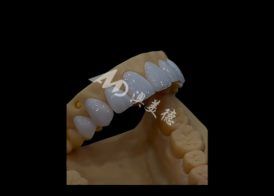 Dobra cena. Protetyka Stomatologia Zirkonia Korona dentystyczna Precyzyjna estetyka w Internecie