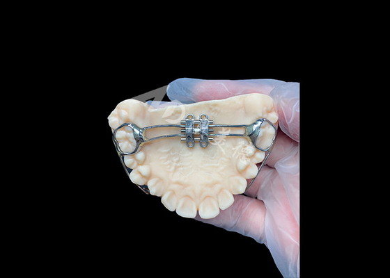 Dobra cena. MSE palatal expander Innowacyjne urządzenia ortodontyczne do skutecznego wyrównania zębów w Internecie