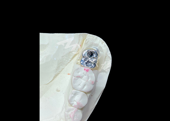 Dobra cena. Korona z implantami dentystycznymi z titanowym podłożem i porcelanową koroną PFM z metalu w Internecie
