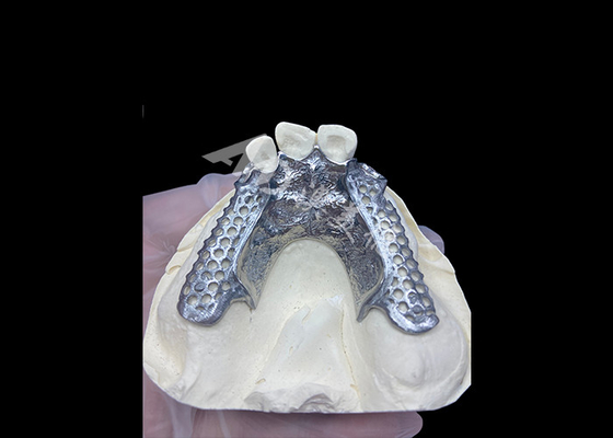 Dobra cena. Łatwe dopasowanie Custom Cast Parcial Denture Stabilna i naturalnie wyglądająca ramka dla szybkich wyników w Internecie