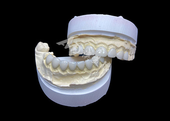 Dobra cena. Zastosowanie Ultra Cienkie Szklane Furniery Ceramiczne Wysokiej Przejrzystości w Internecie