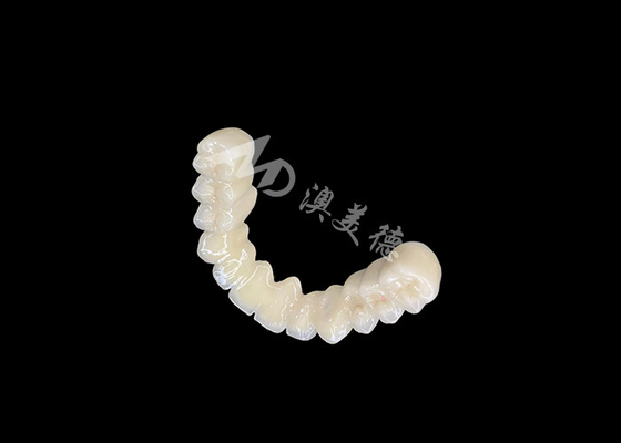 Dobra cena. Długotrwałe wiązanie PFM Dental Crown Bridge z doskonałą biologiczną kompatybilnością w Internecie
