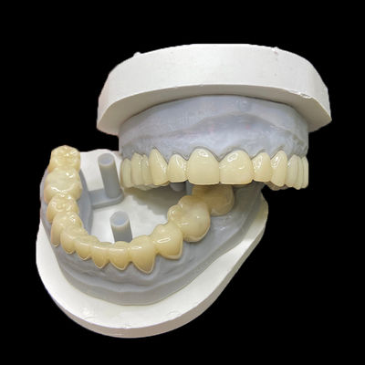 Dobra cena. PMMA Temporary Restorations CAD/CAM PMMA Crowns and Bridges for Provisional Dental Cases w Internecie