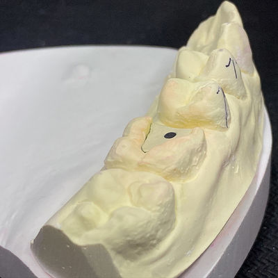 Dobra cena. Reinforce Your Restoration with Lock Pink Post Core Technology w Internecie