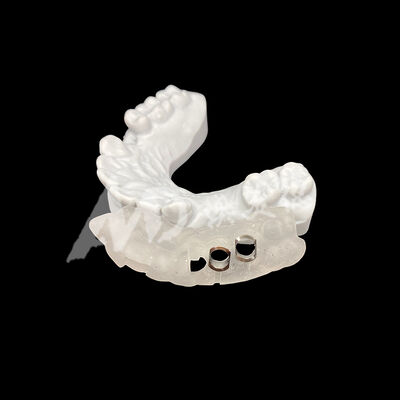 Dobra cena. Precyzyjnie dopasowana, wydrukowana na drukarce 3D prowadnica implantu chirurgicznego o wysokiej odporności na przebarwienia przy użyciu technologii frezowania CAD/CAM w Internecie